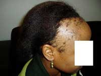 Advanced Hair Clinic - Hair Loss, Regrowth & Thinning Treatment