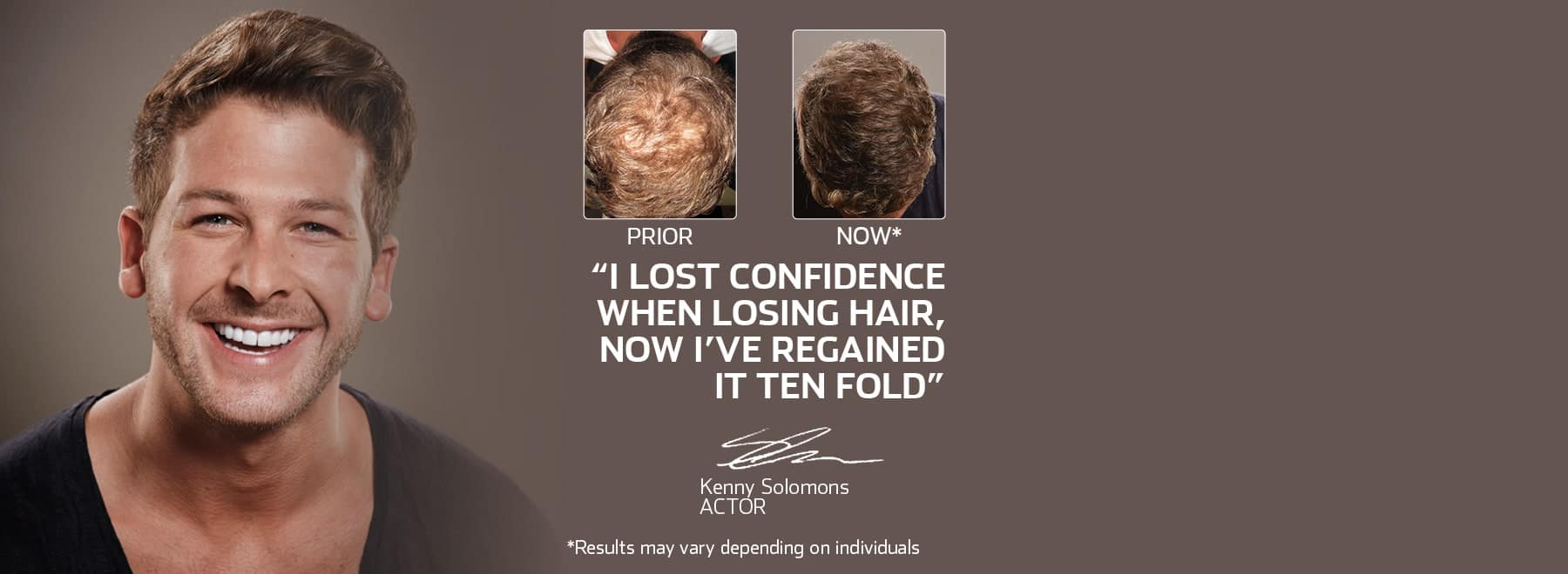 Hair Loss & Growth Treatment South Africa - Advanced Hair Studio