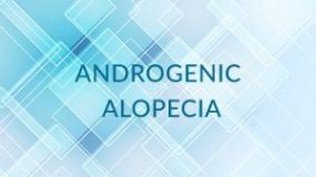 Androgenic Alopecia