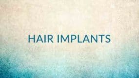 Hair Implants