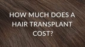 How Much Does A Hair Transplant Cost