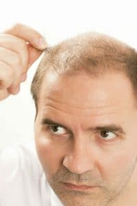 How To Stop Hair Loss