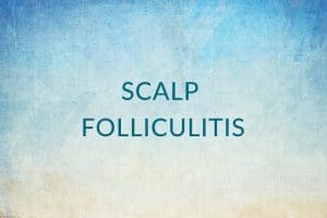 Scalp Folliculitis