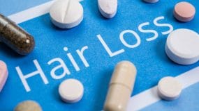 Hair Loss Tablets