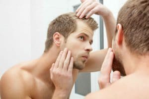 Propecia and Hair Loss