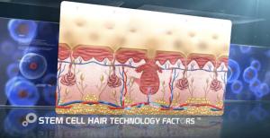 Stem Cell Treatment South Africa