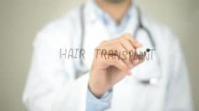 The-FUE-Hair-Transplant-Cost-That-Anyone-Can-Afford