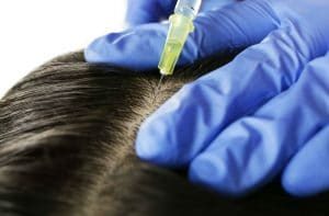 Want-the-Best-FUE-Hair-Transplant