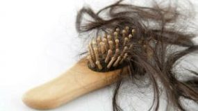 The Best Hair Loss Treatment For Females