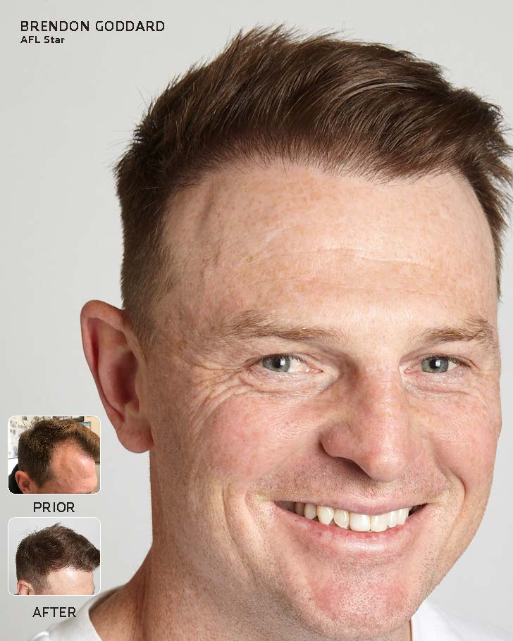 Advanced Hair Brendon Goddard Jpg